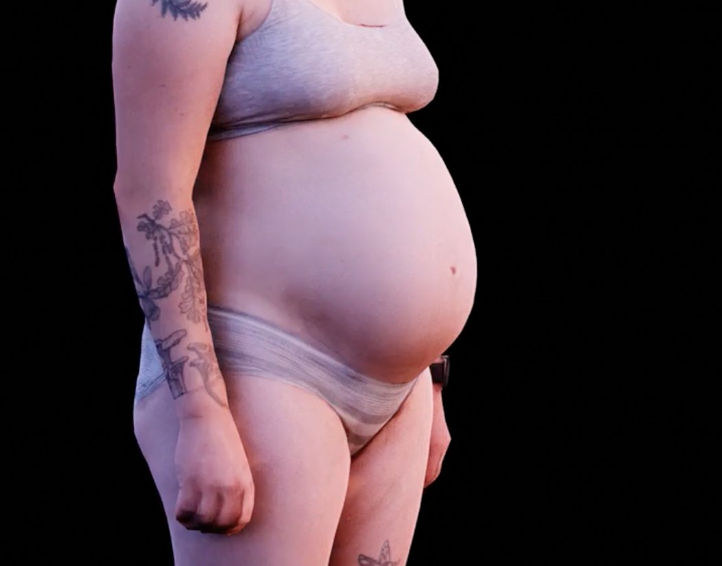Volumetric Pregnancy
